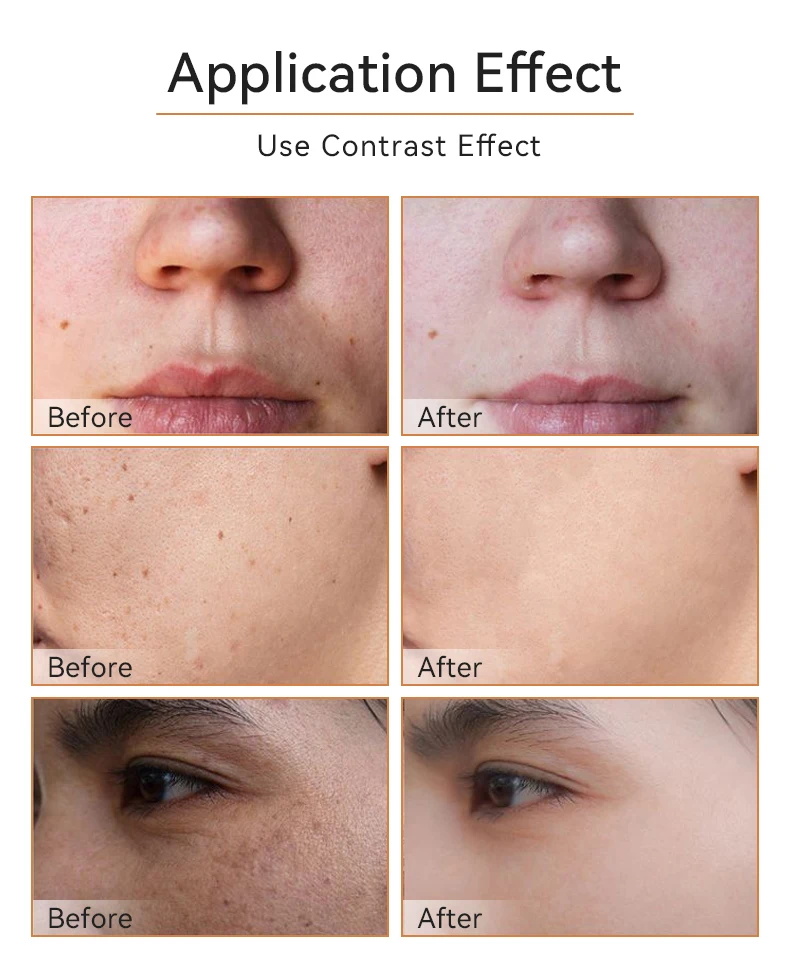 Low MOQ Private Label Luxurious Turmeric Vitamin C Moisturizing Anti-Acne Dark Spot Whitening Facial Serum Cream Oil Set-OEM/ODM