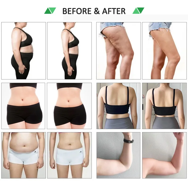 Professional Cold Laser 635nm 532nm Red/Green Light 10D Lipo Slimming Machine Stationary Standing Weight Loss Device