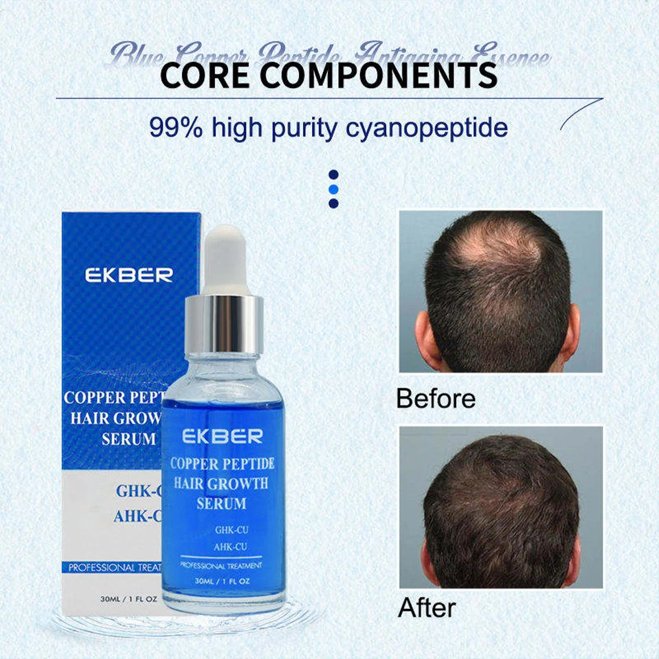 ghk-cu haarausfall Personalisierbares Logo: Haarwuchsserum Gegen Haarausfall Ahk-Cu –  Haarbehandlung mit Ghk-Cu Blauem Kupferpeptid und Biotin