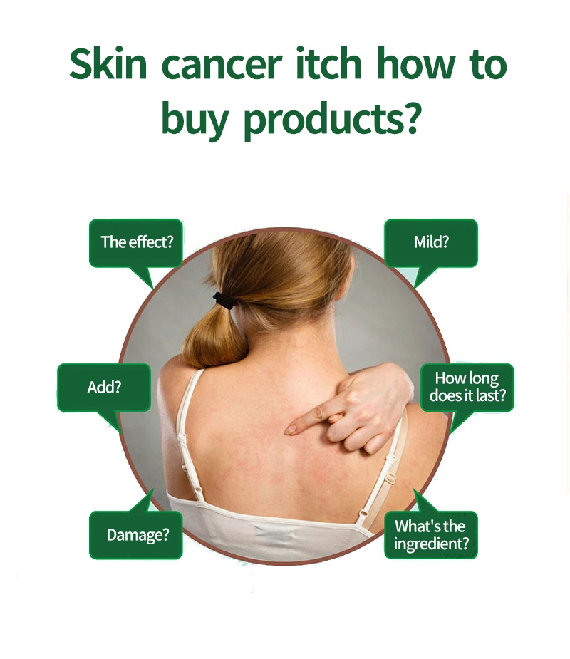 Factory Customization Chinese Herbal Dermatitis Cream Skin Eczema Itching Antipruritic Psoriasis Cream