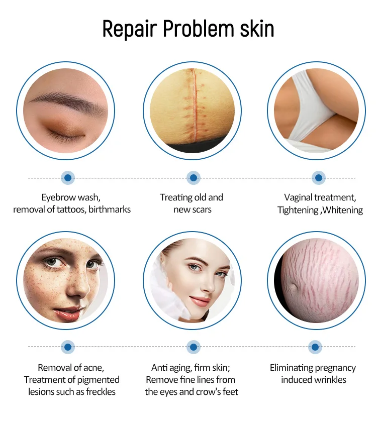 2 in 1 CO2 Fractional Laser+ Q Switch Skin Care Machine for Skin Carbon Peel Professional Fractional Skin Firm