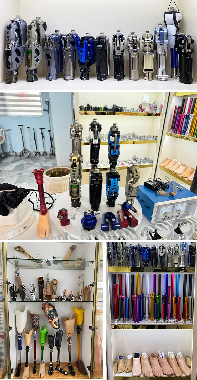 Chinese Manufacturers' Class I Interventional Materials Double Hydraulic Knee Joint Artificial Limb Prosthesis Implantable for