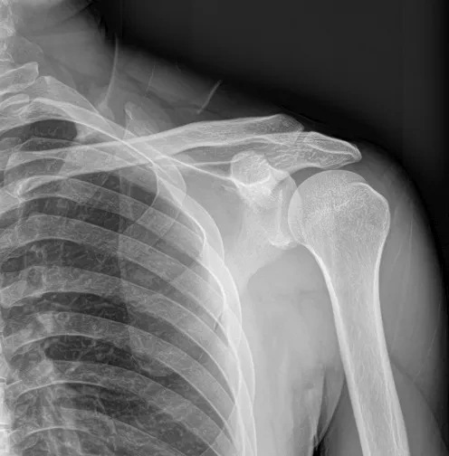 Hot Sale X Ray Fat Panel Dedektor Wired DR Flat Panel Detector for Hospital Use manufacture