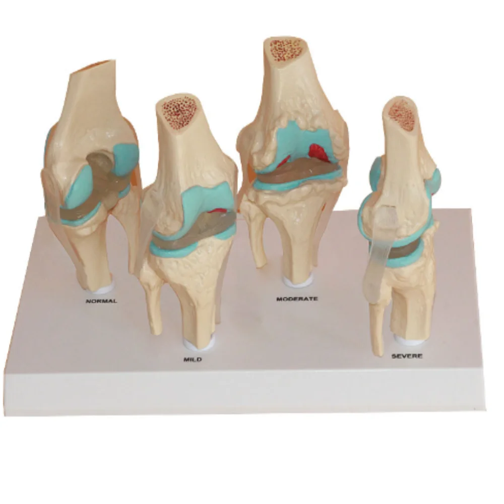 Human Natural Size Knee Joint Anatomical Model Science Educational