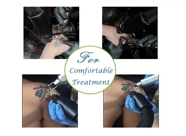 Discover the professional cryo air skin cooling machine designed for laser hair removal, tattoo removal, and aesthetic treatments. −30°C cooling technology improves patient comfort and protects skin during procedures. Professional Cryo Air Skin Cooling Machine for Laser & Aesthetic Treatments