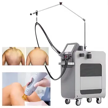 Most Popular High Power alexandrite laser nd yag long pulse 1064nm skin facial and body hair removal alexandrite laser