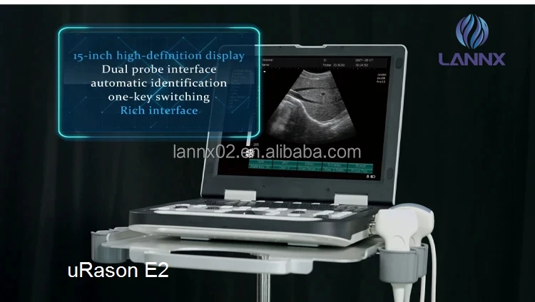 Lannx Urason E2 Ultrasound Diagnostic System Phased Array Cardiac ...