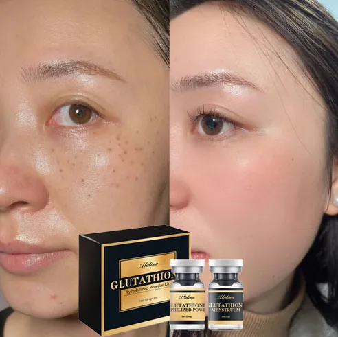customized glutathione powder Custom Logo Glutathione Lyophilized Powder Kit Glow Serum Collagen  Whitening Spot Removal Wrinkles Remover Multi Glutathione AA| Alibaba.com main image 1