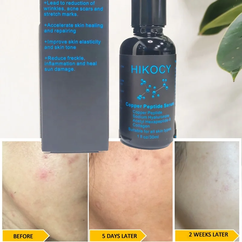ghk cu peptide for acne scars Blue Copper Peptide (GHK-Cu) Guide: Anti-Aging Science, Formulation & OEM main image 0