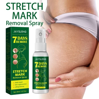 OEM Private Label High Effect Scar Stretch Marks Removal Cream Massage Spray for Stretch Marks Pregnancy Skin Care