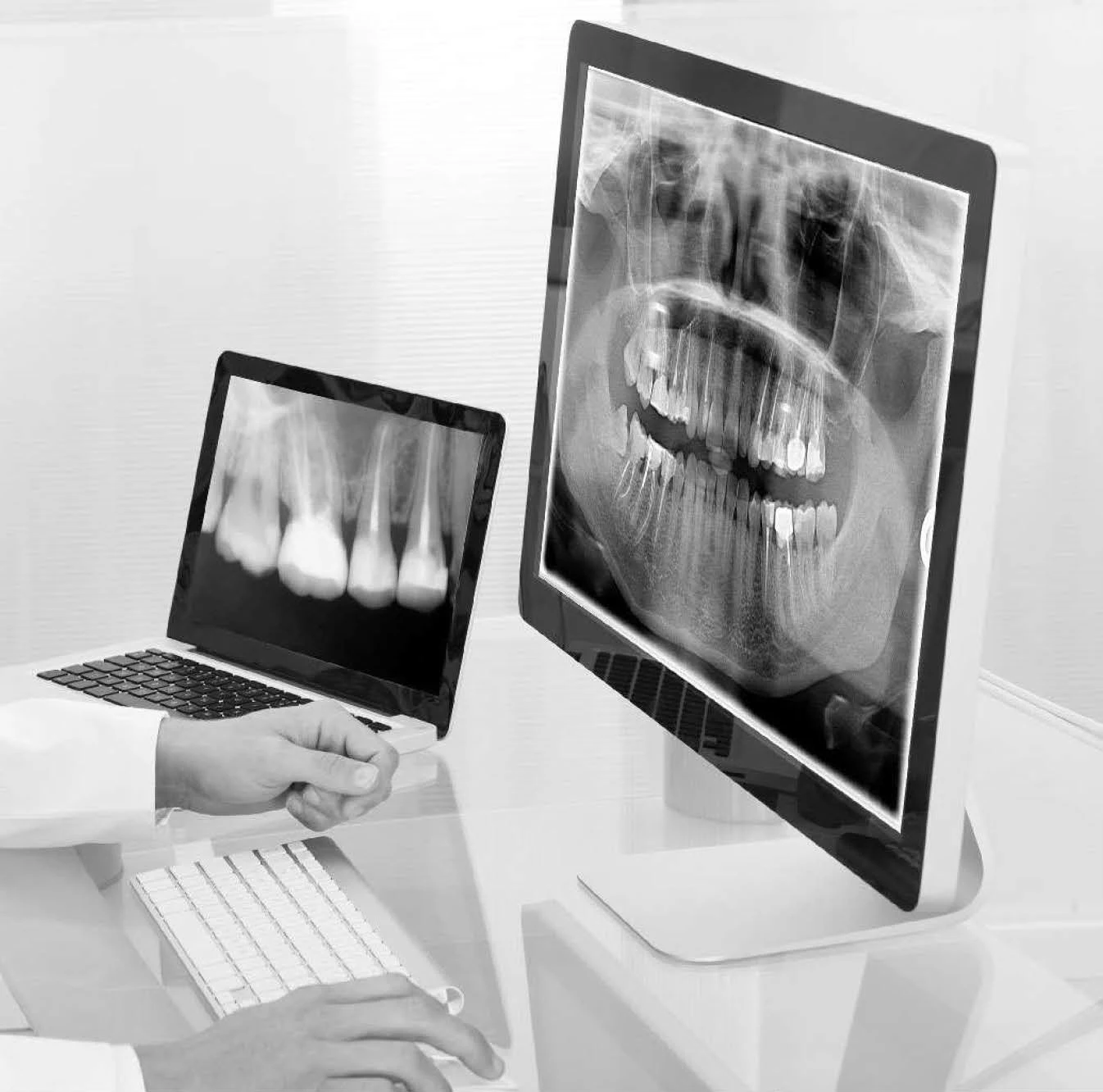 High Frequency Digital Portable Intraoral Xray Dental Xray Machine For