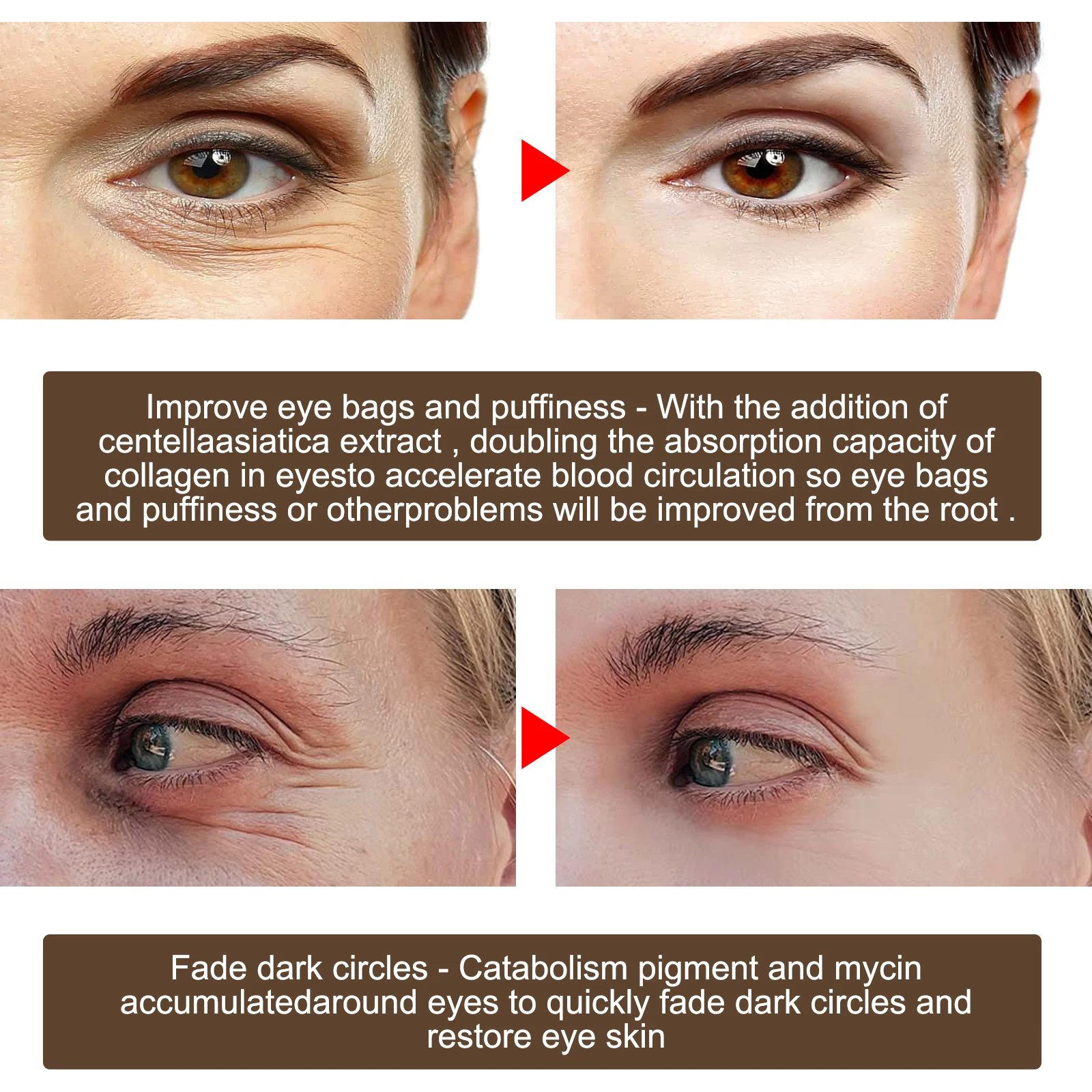 Eelhoe Serum Eye Cream Firming And Lifting Eye Bags Fade Eye Wrinkles
