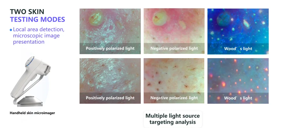 Skin Test Using Automat Portable Skin test Artificial Intelligence 14 Indicator Facial Skin ...