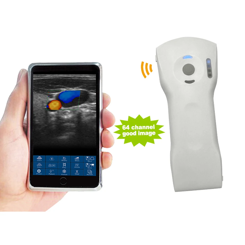Suresult Professional Medical Devices: Wireless USG Ultrasound Probe for IPhone & IPad