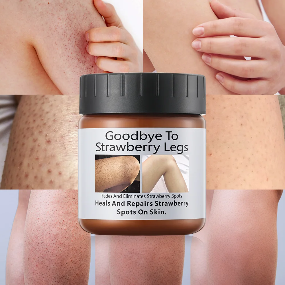 Private Label Remove Chicken Skin Repair Strawberry Spots Legs Cream Exfoliating Bumps Smooth Tender Moisturizing Body Cream