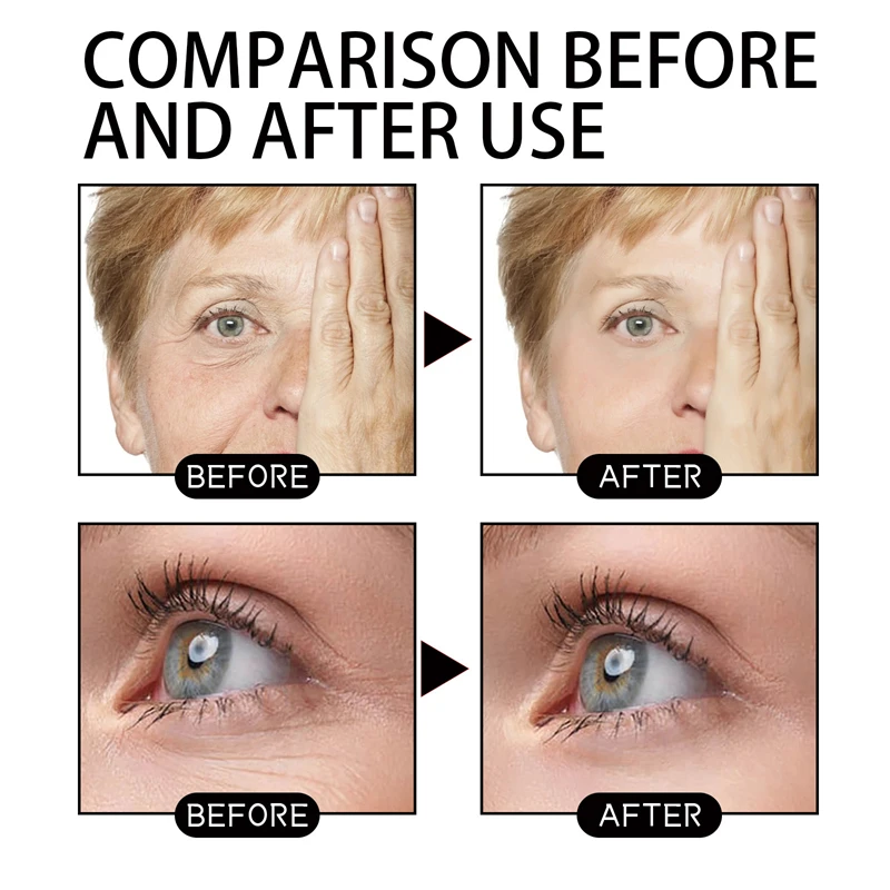 Jaysuing 50ml Firming Skin Cream Interfrontal Stria Eyeprint Nasolabial Fold Neck Lines Improving Face Moisturizing Cream