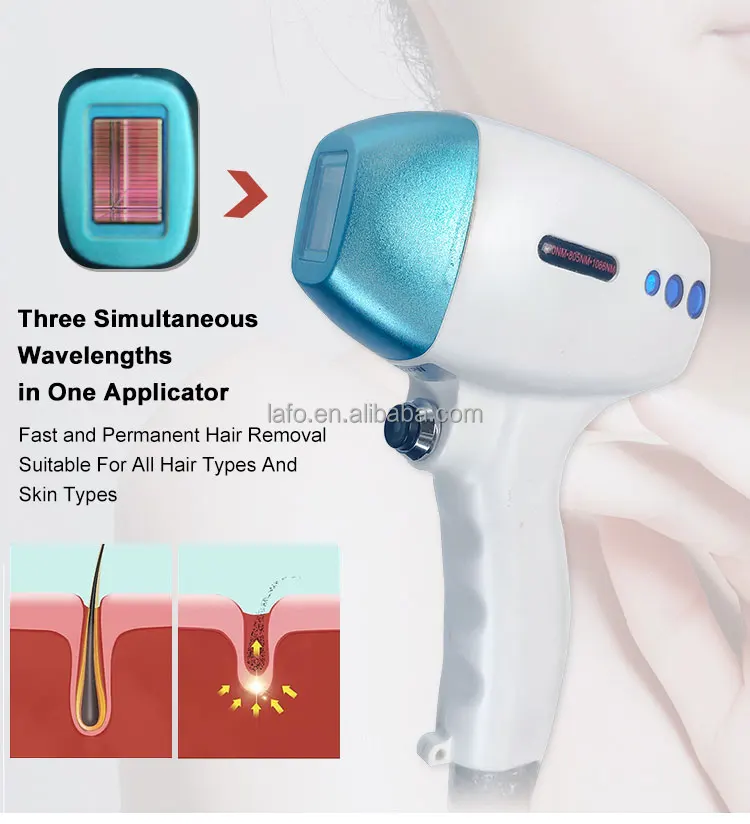 Ozero Khanka Pioneer Laser hair Remove 808nm Hair Removal Machine Okl pioneer laser