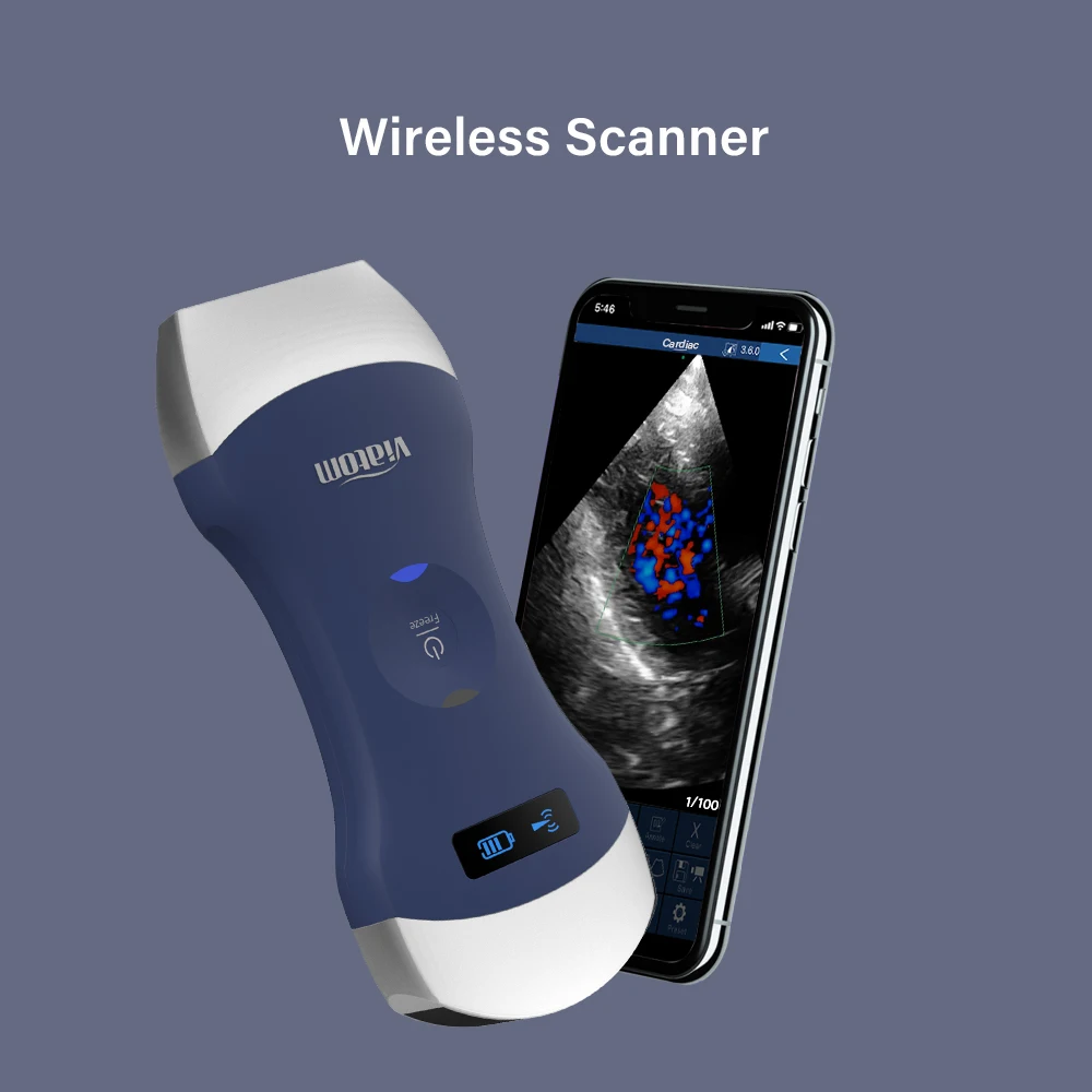 Viatom Mini Wirless Ultrasound Scanner - Oxyaider