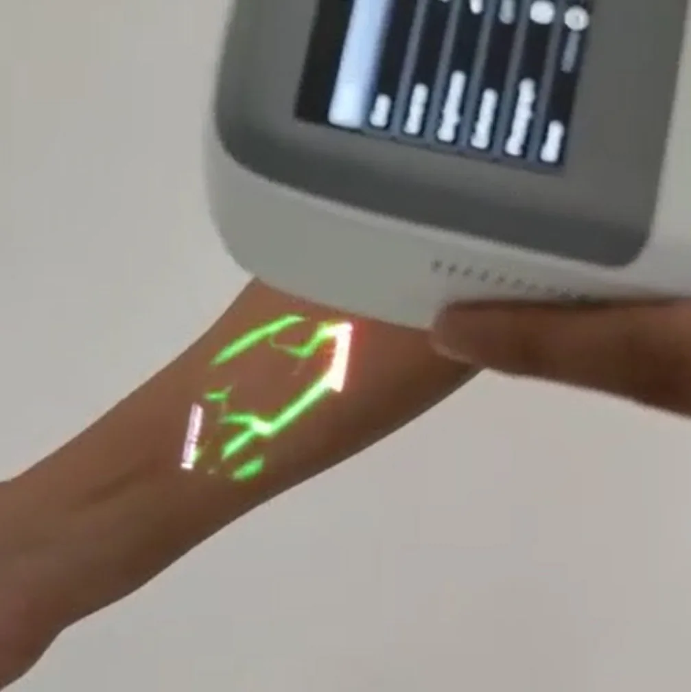 Veterinary Medical Aid Equipment Cheap QV-600 Injection Vein Finder Machine Portable Medical Vein Detector for Face