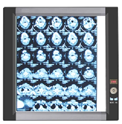 2020 hot sales hospital instruments ultra thin LED single panel medical x-ray film viewe