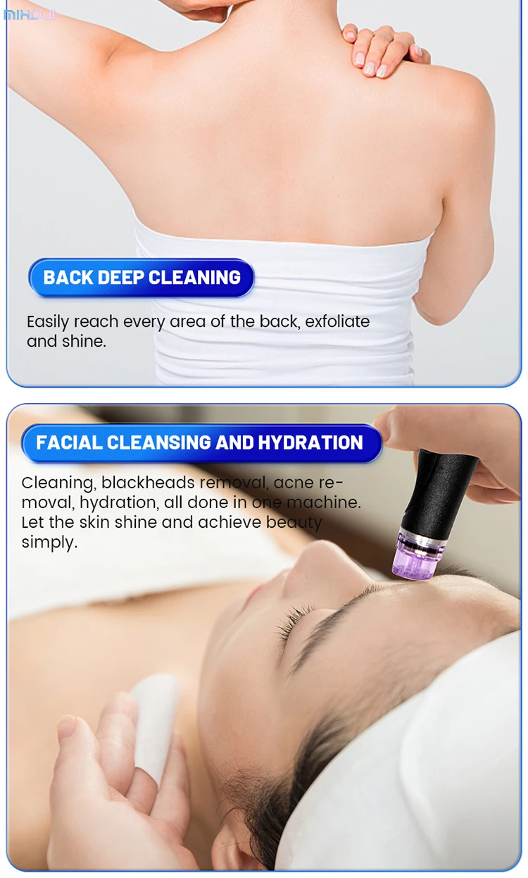 Commercial Hydrafacial Machine with 1 Year Warranty 3 Handles and 220W Working Power for Skin Rejuvenation