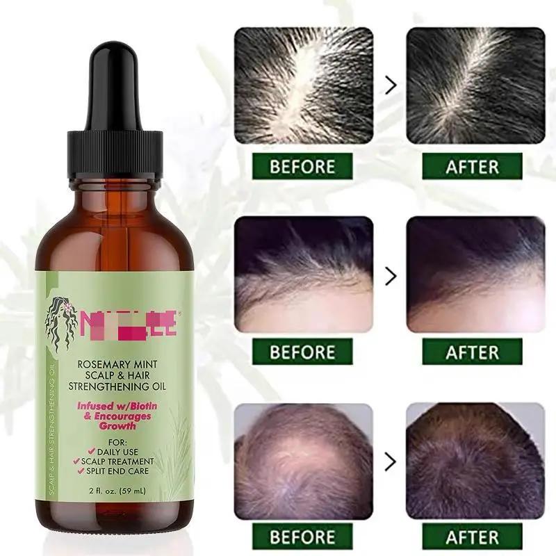 High Quality Mielle Hair Serum Essential Oil Rosemary Mint Strong 59ml ...