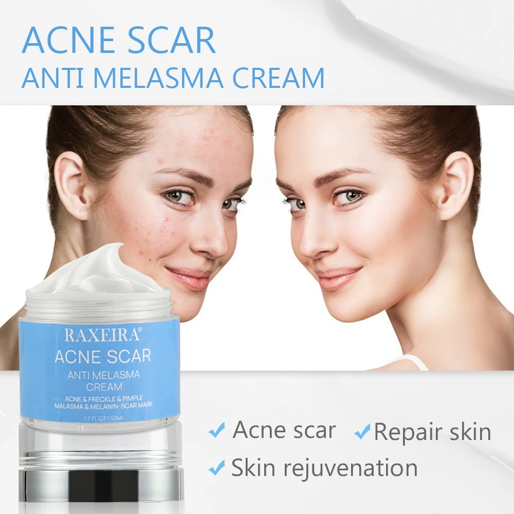 Private Label Wholesale Remove Anti Melasma Cream Day Night Lightening ...