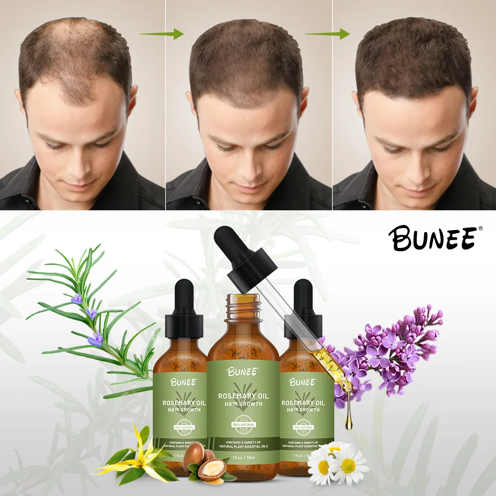 60ml Oem Organic Formula Leave In Premium Quality Booster Hair Follicle