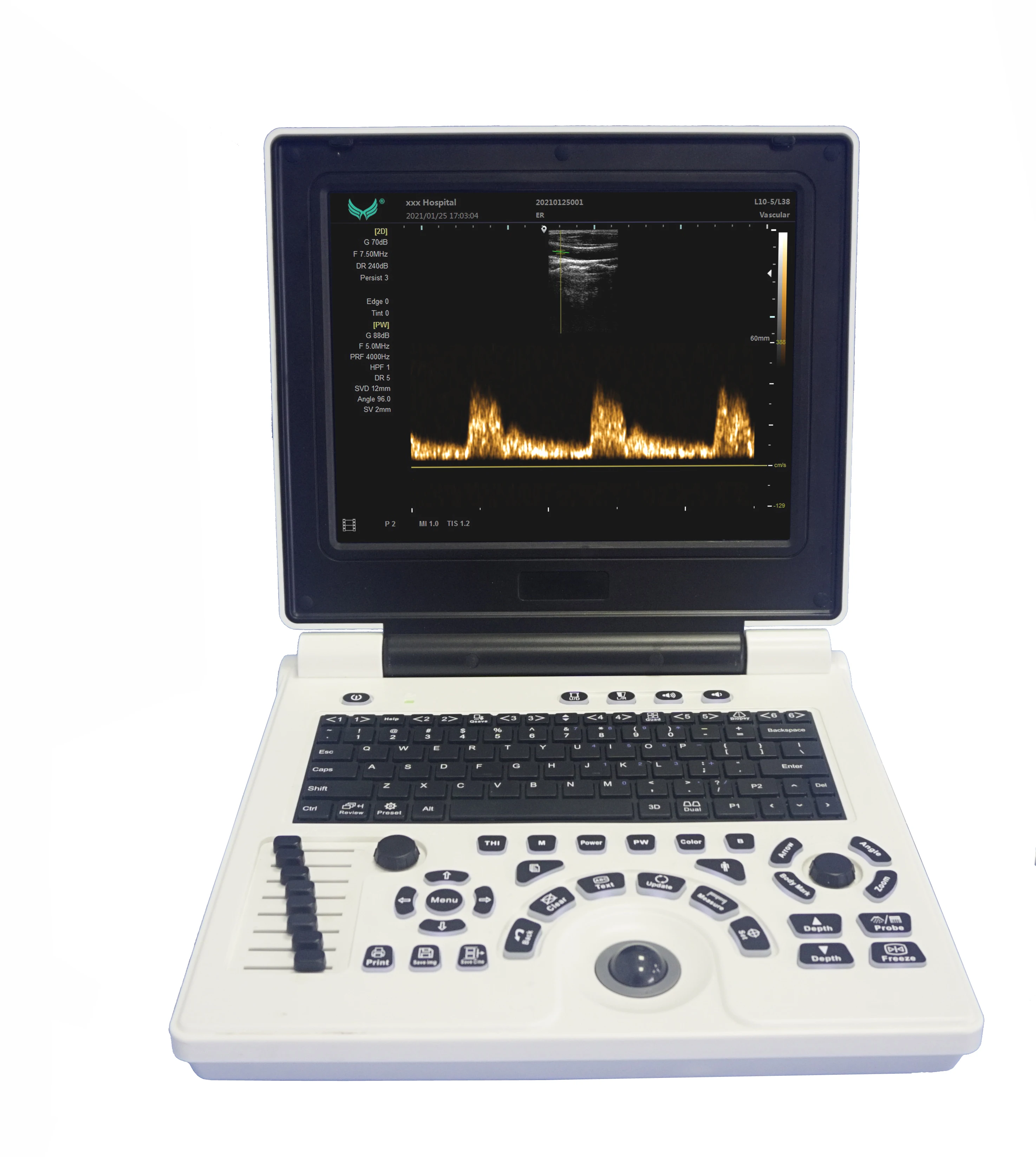 PW Laptop Ultrasound Machines Black And White THI Imaging Technology