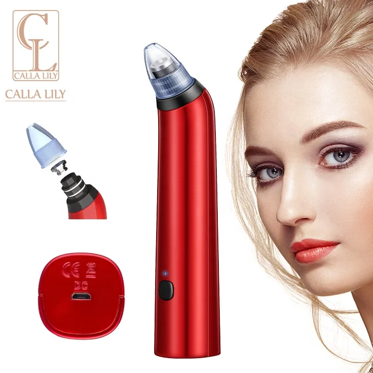 
Легкий способ удаления черных точек на лице, удаление черных точек и белых точек в домашних условиях 