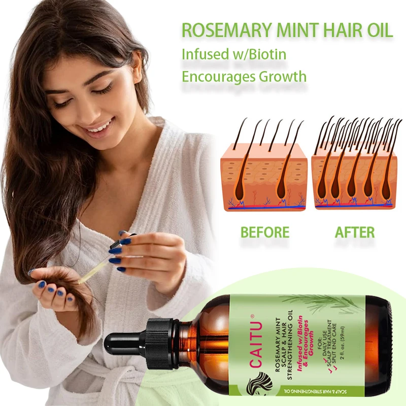 Hotsell 4c Hair Growth Oil Organic Rosemary Oil Hair Growth Hair