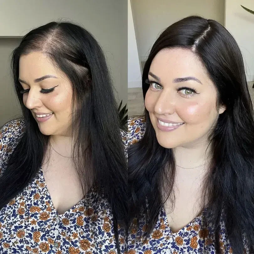 15x16cm Virgin Human Hair Silk Top Injected Skin Base Toupee Natural Scalp Hairpiece for Women_voghion.com