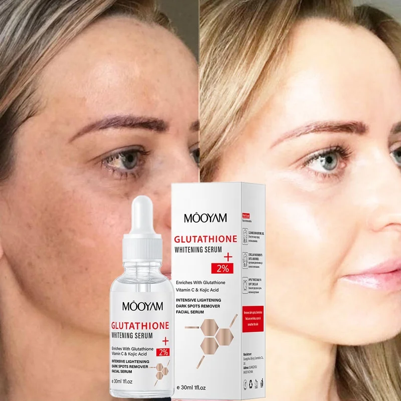 does glutathione help you poop What Causes Melasma and How To Treat It? main image 0