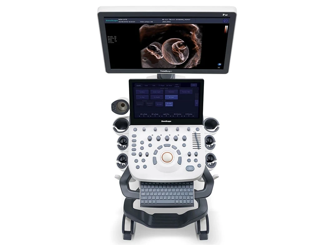 Sonoscape P20 Mobile 3D/4D Real-time Color Panoramic Doppler Trolley Ultrasound Machine details