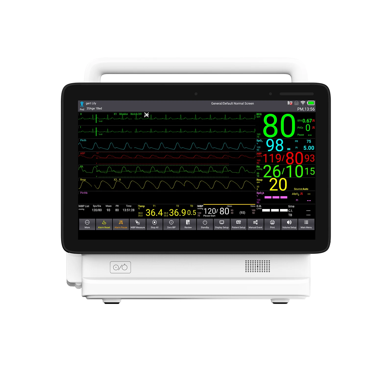 CONTEC TS13 TS1 серии, новый дизайн, для больницы, ICU, вилка для пациента