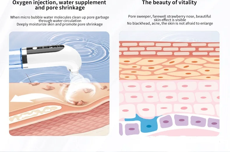 Most Popular Home Use Blackhead Remover Vacuum Small Bubble Facial