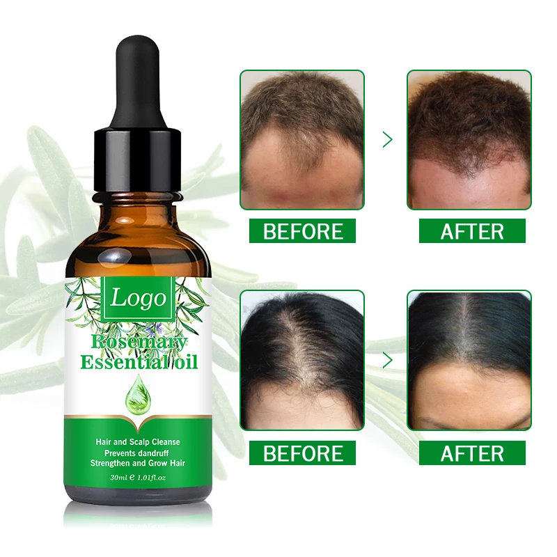 Private Label Natural Multipurpose Rosemary Oil Hair Growth Scalp Serum ...