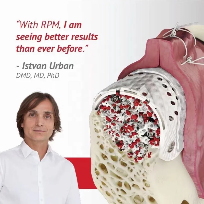 Omnes Magnitudines Consumabilia Medica Non-absorbibilia Membrana pro Implantis Dentalibus, Membrana PTFE pro GBR, Materialis Reconstructivus Ossium