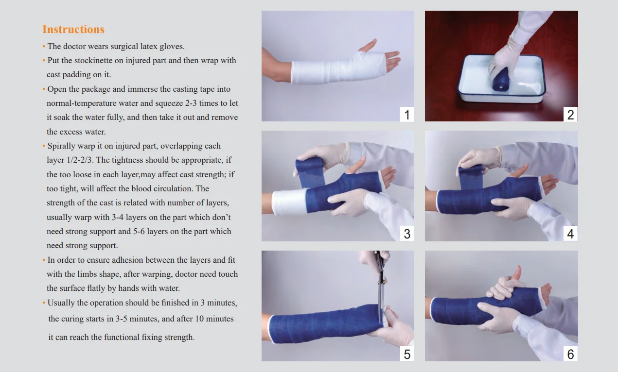 Medical Fiberglass Products Cast Tape Bandage Buy Fiber Cast Bandage