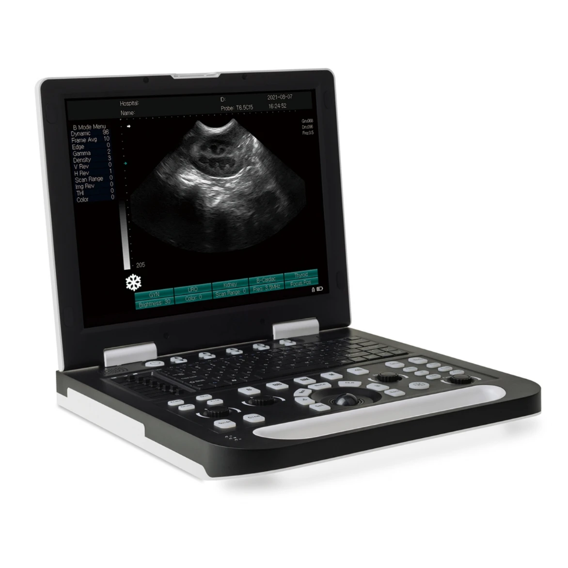 High Quality Hospital Use Portable All Digital Laptop Ultrasound Machine With Dual Probe Interface