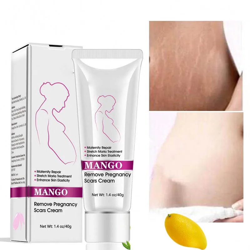 where to buy aloe Aloe Vera main image 0