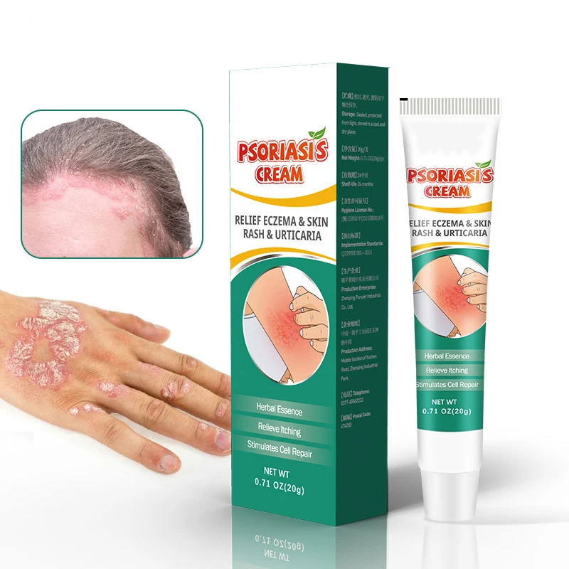 quick effective pure natural chinese herbal dermatitis pruritus psoriasis treatment cream ointment for skin problem