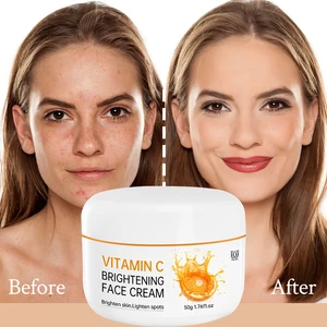 Calantha  Acne Treatment Vitamin C Face Cream & Lotion Whitening Acne Pimple Mark Removal Dark Spots Facial Skin Care