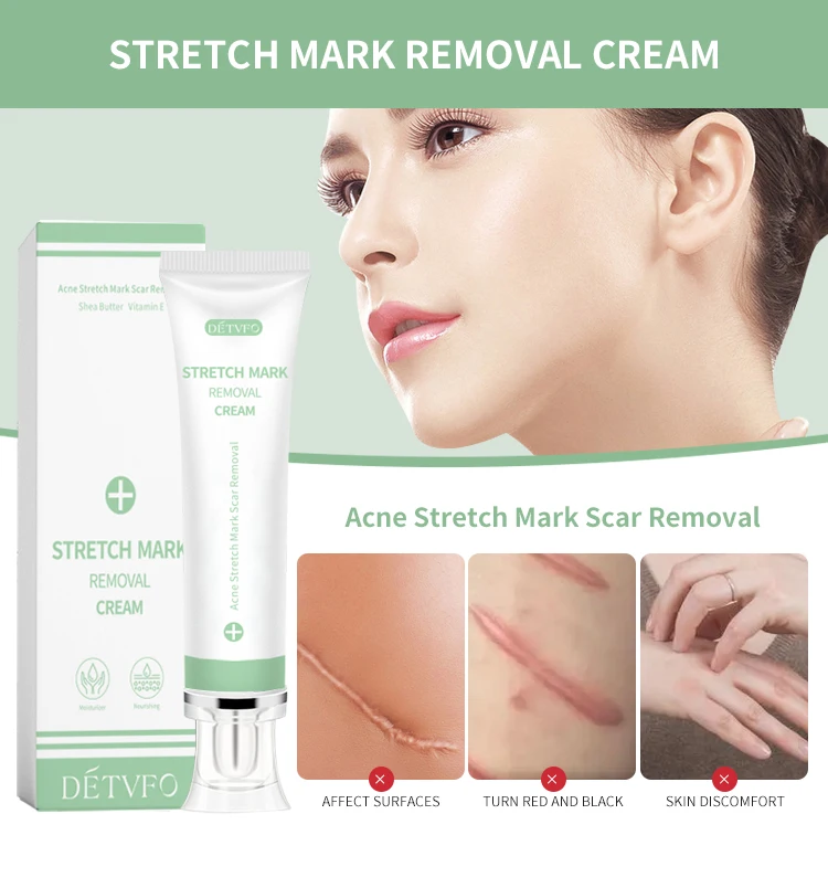 Best Anti-stretch Scar Dark Marks Extreme Repair Original Anti Stretch ...