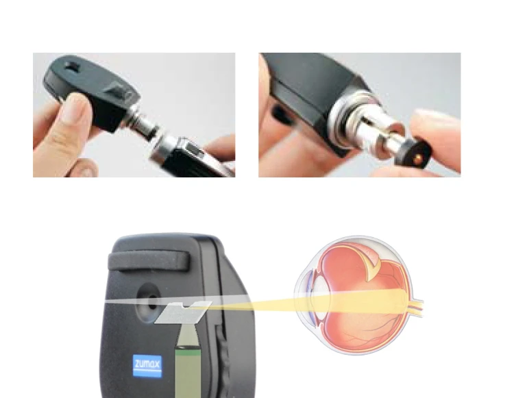 High Quality Professional Ophthalmic Equipment Retinoscope Optical Rechargeable Direct