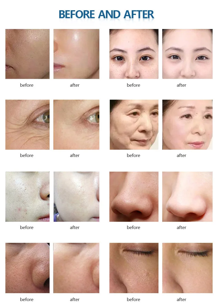 SPA10 NEW (9)
