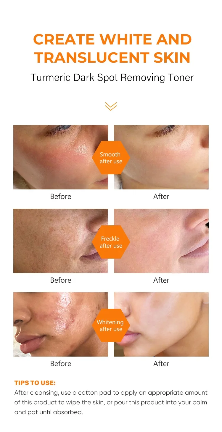 Private Label Dark Spots Eraser Turmeric Toner Brightening Fades