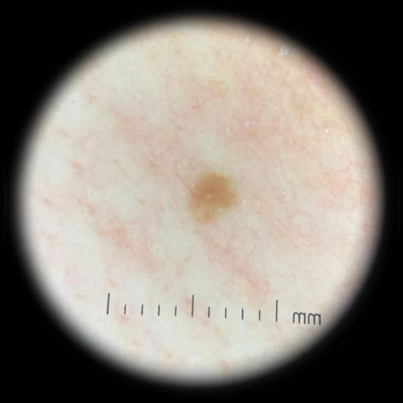 IBOOLO DE-300 для домашнего использования поляризованный дерматоскоп