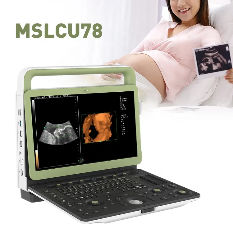 Medsinglong Ultrasound Scanner Machine Ecocardiografo Portatil Human Pregnancy Color Doppler Portable 4D Ultrasound Machine