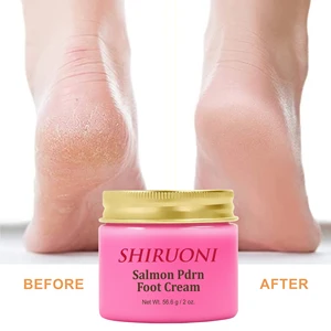 OEM Salmon PDRN Foot Cream Hydrating Moisturizing Cream Dry Sensitive Skin Smooth Urea Ceramide Squalane Vitamin B5 Foot Cream